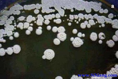 俄罗斯科学家给自己注射350万年前永生细菌